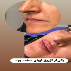 f7df3978-c051-44bd-9120-57b4c6299fa3