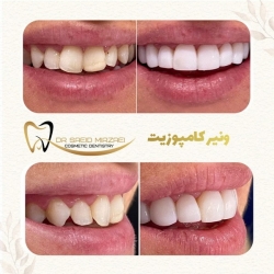 dr_mirzaei_263713127_612241486489682_2154691821460070352_n